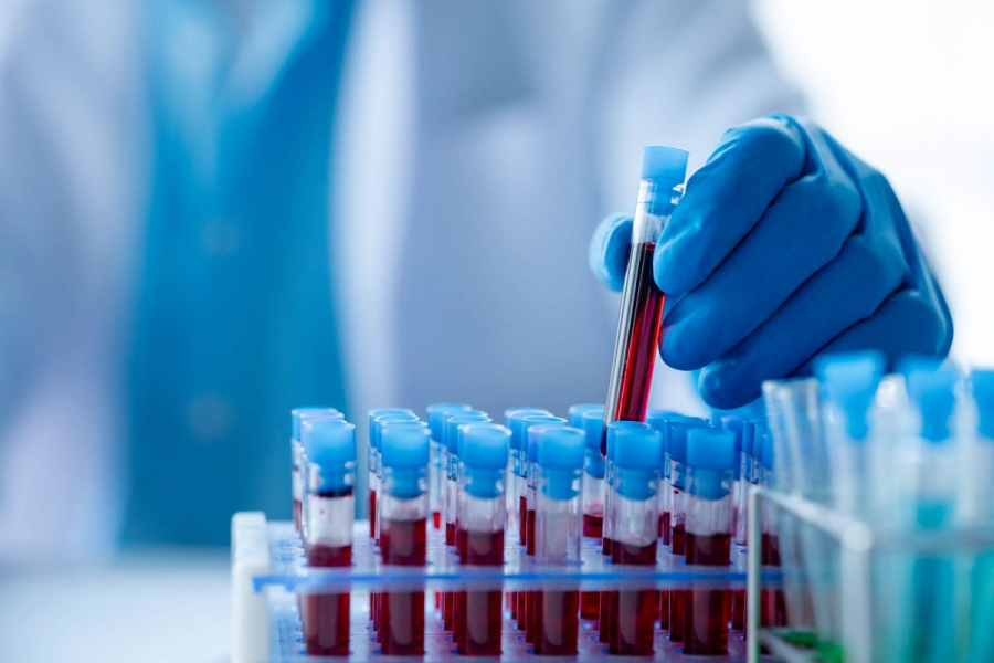 How Does Blood Testing Reveal the Secrets of One's Health?